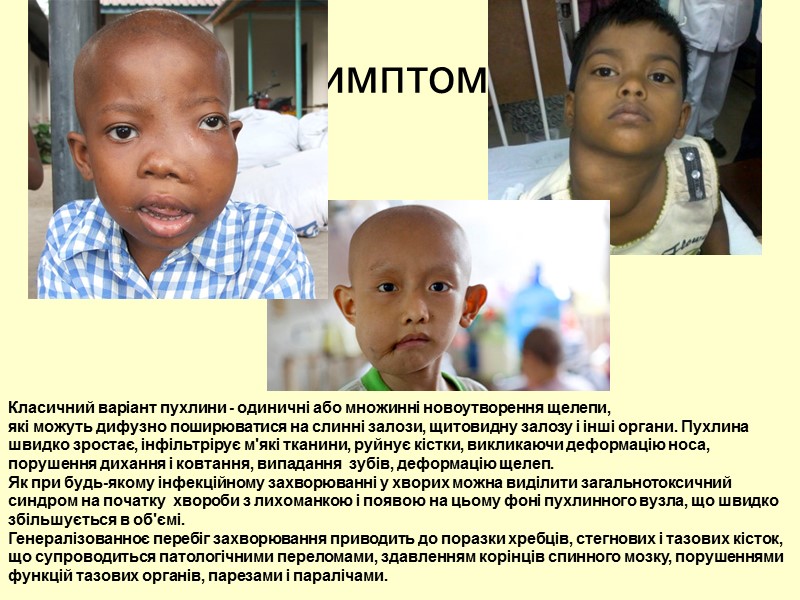 Симптоми Класичний варіант пухлини - одиничні або множинні новоутворення щелепи,  які можуть дифузно